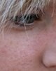 Karin Herzog Acne & Congestion