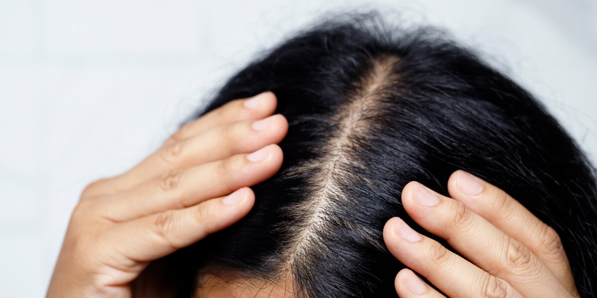 What Is a Scalp Serum and Do You Need One?