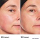 Skin Therapy Light