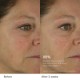 The Dewy Skin Cream