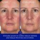 The Hydrogel Face Mask