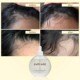Moonlight Scalp Serum