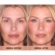 UNREAL BLUSH HEALTHY GLOW STICK 9g