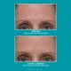 Peptide Skinjection™ Amplified Wrinkle-Fix Serum