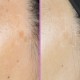 Spotless Protocol – Anti-pigmentation serum with Niacinamide, Vitamin C & HA