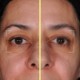 Bightening Capsules - Serum