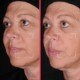 Lift Protocol – Firming serum with Niacinamide, Peptide & Hyaluronic Acid