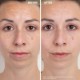 Anti-Redness Clarifying Care Serum