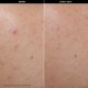CLEAR & PURIFY Clear Skin Serum