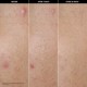CLEAR & PURIFY Clear Skin Serum