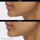 Lifting Jawline & Neck Mask