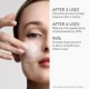 T.L.C. Sukari Babyfacial™ Reformulation