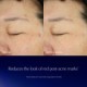 Advanced Night Repair Recovery Treatment Lotion