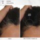 FutureIQ™ hair longevity serum for graying, thinning, and scalp aging