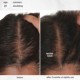 FutureIQ™ hair longevity serum for graying, thinning, and scalp aging