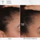 FutureIQ™ hair longevity serum for graying, thinning, and scalp aging