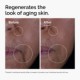 The Renewal Set for Signs of Aging