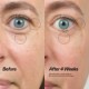 Bio-active Ceramide Eye Cream