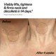 Bio-active Ceramide Neck Stick