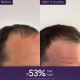 Anti-Hair Loss Serum