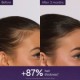 Anti-Hair Loss Serum