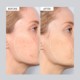 T.L.C. Sukari Babyfacial™