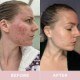 Premium Liquid Marine Collagen Drink