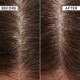 Flaky Scalp Anti-Dandruff Shampoo