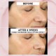 Forget the Filler Skin-Plumping Line-Smoothing Moisturizer 50g