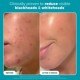 Skin Perfecting 2% BHA Liquid Exfoliant - Travel Size