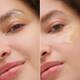 De-Puffing & Anti-Dark Circles