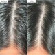 Scalp Revival™ Charcoal + Biotin Dry Shampoo