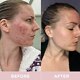 Revive Collagen Original 2 Month Bundle