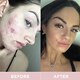 Revive Collagen Original 2 Month Bundle